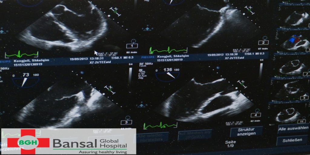 Postrate Ultrasound