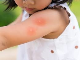 Ways to prevent your child from Dengue